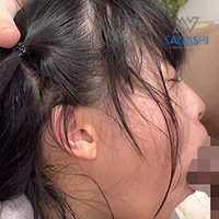 比奈ひまり